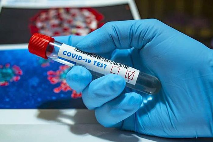 Covid-19 : 63 nouveaux cas dont 13 communautaires, 68 guéris, 34 cas graves, 2 décès....