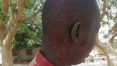 Lycée Sanghé de Thiès, un professeur blessé à la tête par un élève