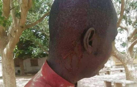 Lycée Sanghé de Thiès, un professeur blessé à la tête par un élève