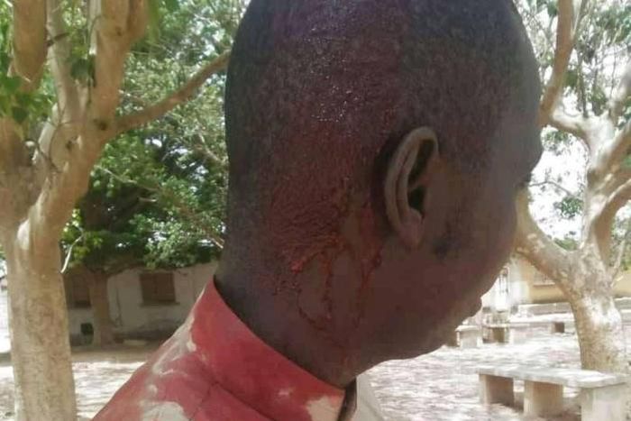 Lycée Sanghé de Thiès, un professeur blessé à la tête par un élève