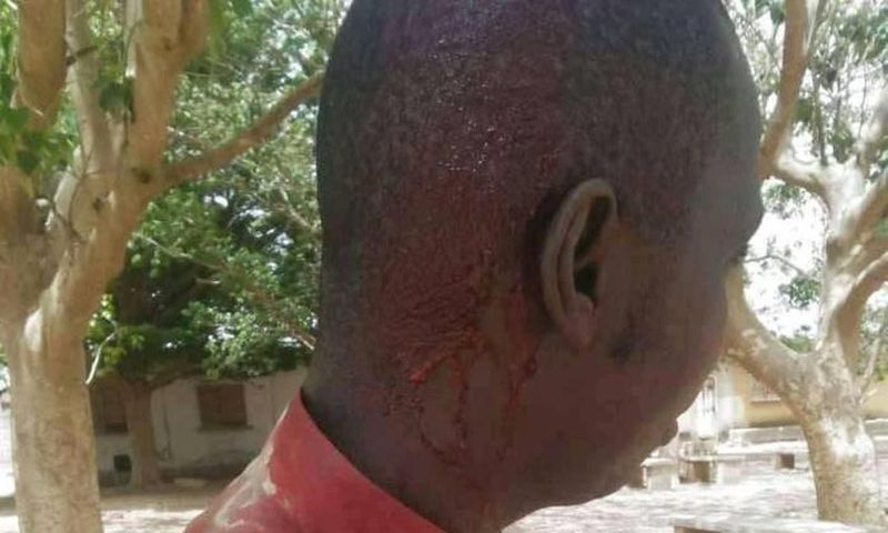 Lycée Sanghé de Thiès, un professeur blessé à la tête par un élève