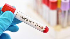 COVID-19 : 36 NOUVEAUX CAS, 1 DÉCÈS ET 23 CAS GRAVES