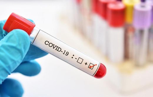 COVID-19 : 36 NOUVEAUX CAS, 1 DÉCÈS ET 23 CAS GRAVES