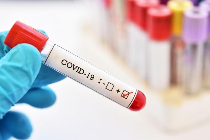 COVID-19 : 36 NOUVEAUX CAS, 1 DÉCÈS ET 23 CAS GRAVES