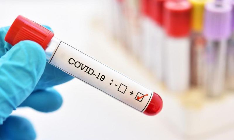 COVID-19 : 36 NOUVEAUX CAS, 1 DÉCÈS ET 23 CAS GRAVES