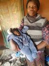 une jeune femme donne naissance à un enfant atteint de progeria