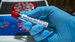 CORONAVIRUS : 68 NOUVEAUX CAS POSITIFS, HAUSSE DES CAS GRAVES