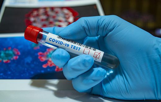 CORONAVIRUS : 68 NOUVEAUX CAS POSITIFS, HAUSSE DES CAS GRAVES