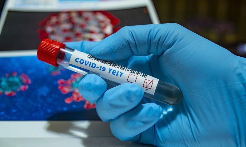 CORONAVIRUS : 68 NOUVEAUX CAS POSITIFS, HAUSSE DES CAS GRAVES
