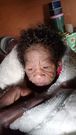 une jeune femme donne naissance à un enfant atteint de progeria