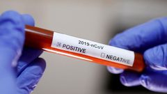 CORONAVIRUS : 130 CONTAMINATIONS ET UN DÉCÈS OFFICIALISÉS VENDREDI