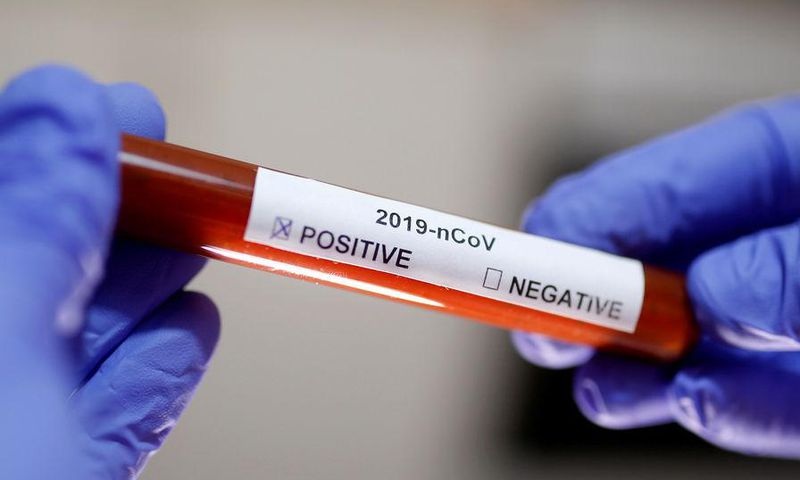 CORONAVIRUS : 130 CONTAMINATIONS ET UN DÉCÈS OFFICIALISÉS VENDREDI