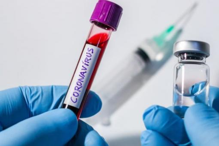 COVID-19 : AUCUN DÉCÈS, 17 NOUVEAUX CAS DONT 4 IMPORTÉS