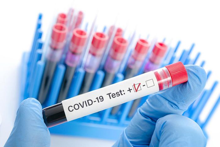 Covid-19 : 83 nouveaux cas dont 41 communautaires, 47 guéris, 33 cas graves, aucun décès ....