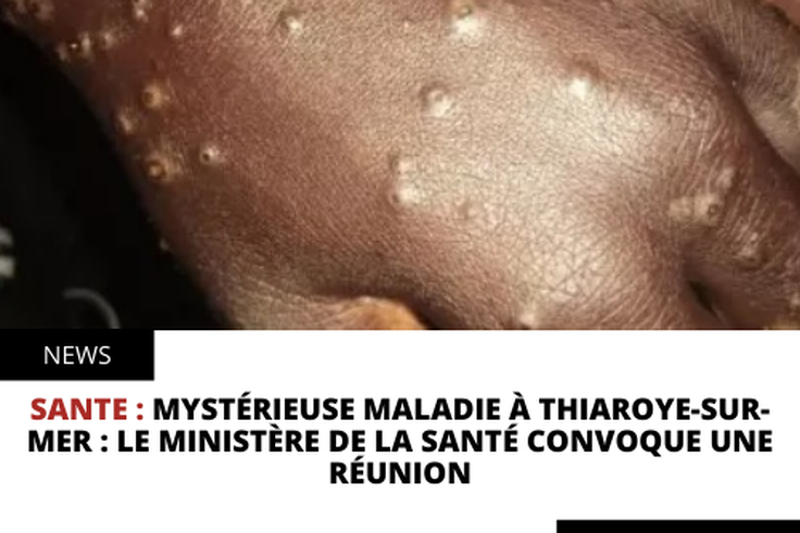 Mystérieuse maladie à Thiaroye-sur-mer : le ministère de la santé convoque une réunion