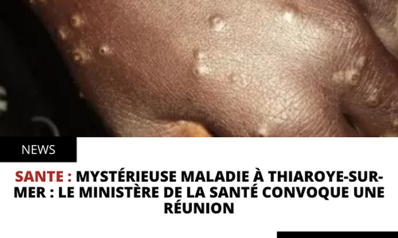Mystérieuse maladie à Thiaroye-sur-mer : le ministère de la santé convoque une réunion