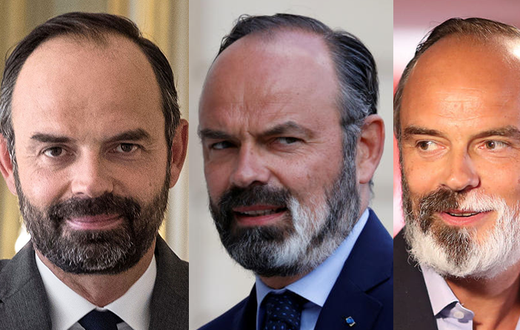 Edouard-Philippe---vitiligo