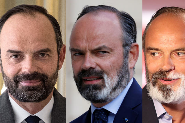 Edouard-Philippe---vitiligo