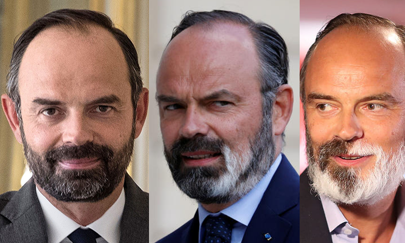 Edouard-Philippe---vitiligo