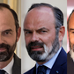 Edouard-Philippe---vitiligo