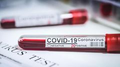 CORONAVIRUS : PERSISTANCE DES CAS COMMUNAUTAIRES DANS 44 LOCALITÉS, SITUATION INQUIÉTANTE À ZIGUINCHOR