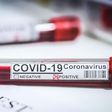 CORONAVIRUS : PERSISTANCE DES CAS COMMUNAUTAIRES DANS 44 LOCALITÉS, SITUATION INQUIÉTANTE À ZIGUINCHOR