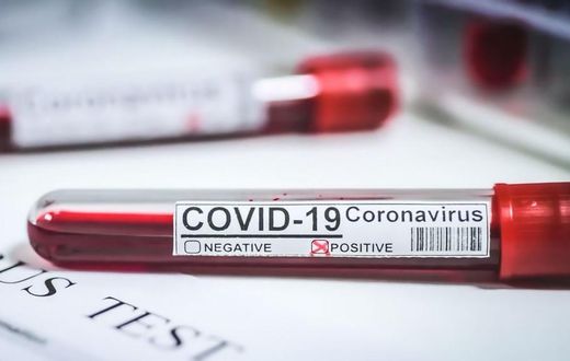 CORONAVIRUS : PERSISTANCE DES CAS COMMUNAUTAIRES DANS 44 LOCALITÉS, SITUATION INQUIÉTANTE À ZIGUINCHOR