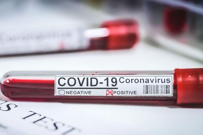 CORONAVIRUS : PERSISTANCE DES CAS COMMUNAUTAIRES DANS 44 LOCALITÉS, SITUATION INQUIÉTANTE À ZIGUINCHOR