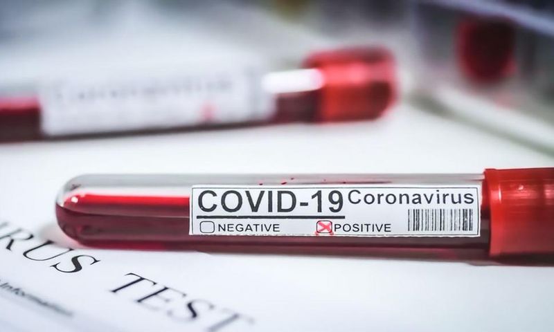 CORONAVIRUS : PERSISTANCE DES CAS COMMUNAUTAIRES DANS 44 LOCALITÉS, SITUATION INQUIÉTANTE À ZIGUINCHOR