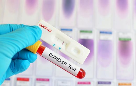 Covid-19 : 1 décès supplémentaire et 25 nouveaux cas...