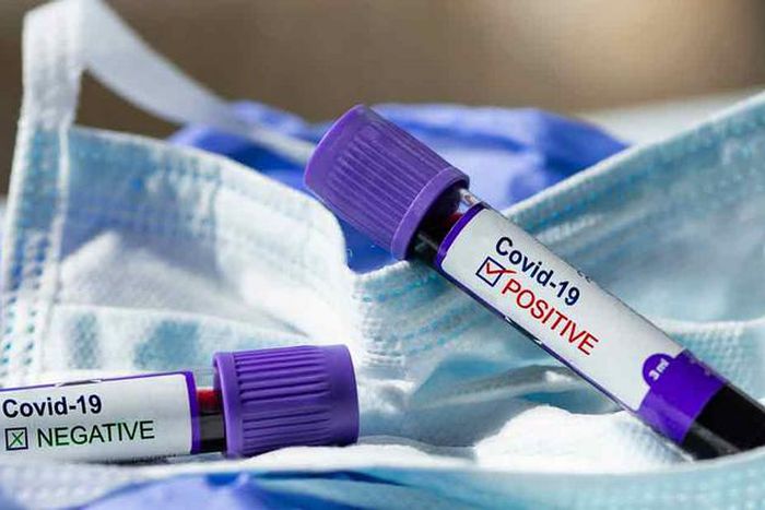 Covid-19 : 48 nouveaux cas dont 20 communautaires, 0 décès, 34 cas graves....