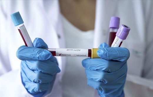 COVID-19 : NOUVELLE HAUSSE DU TAUX DE POSITIVITÉ, 1 DÉCÈS ENREGISTRÉ