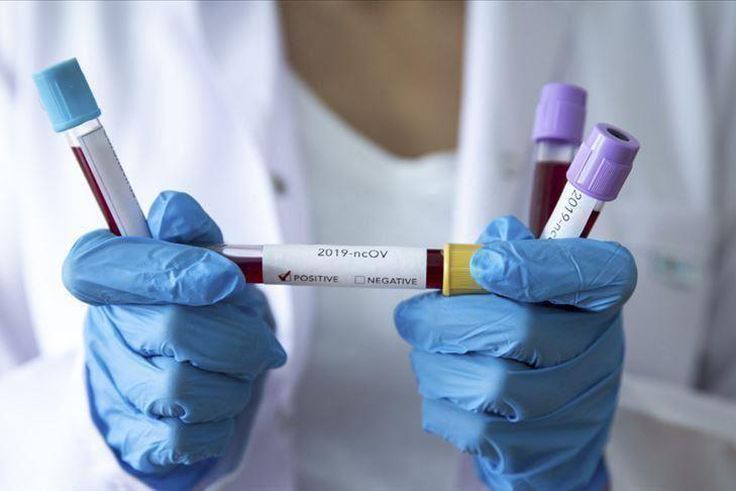 Covid-19 : 110 nouveaux cas dont 29 communautaires, 1 cas importé, 67 guéris, 4 nouveaux décès...