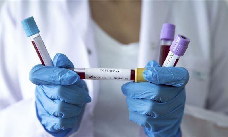Covid-19 : 89 nouveaux cas dont 17 communautaires, 1 cas importé, 110 guéris, 1654 patients sous traitement