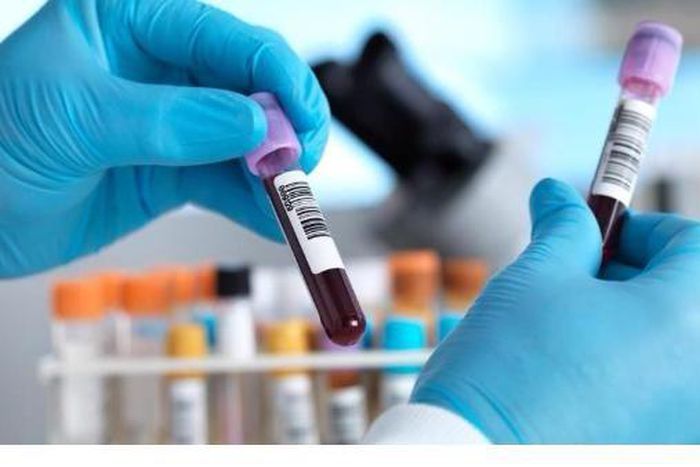 COVID-19 : DAKAR ÉPICENTRE DE LA MALADIE, BAISSE DRASTIQUE DES CAS CONTACTS