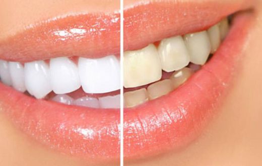 Comment blanchir vos dents avec des écorces de banane