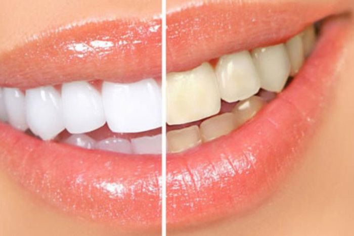 Comment blanchir vos dents avec des écorces de banane