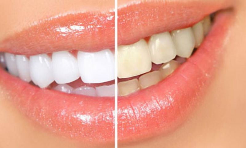 Comment blanchir vos dents avec des écorces de banane