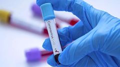 covid-19-coronavirus-senegal