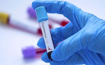 covid-19-coronavirus-senegal