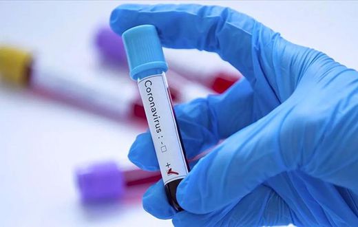 covid-19-coronavirus-senegal