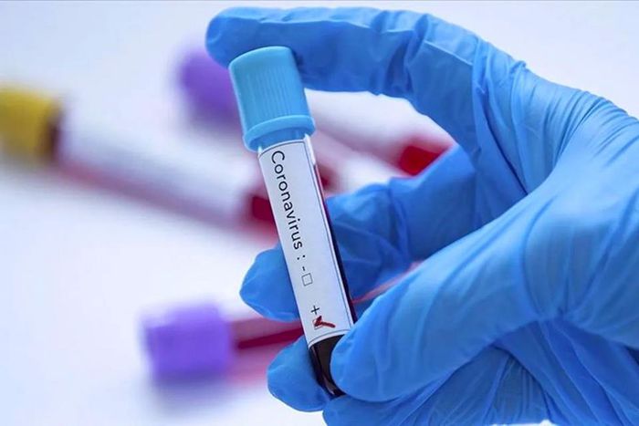 covid-19-coronavirus-senegal