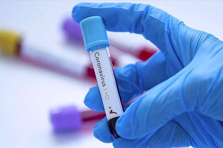 covid-19-coronavirus-senegal