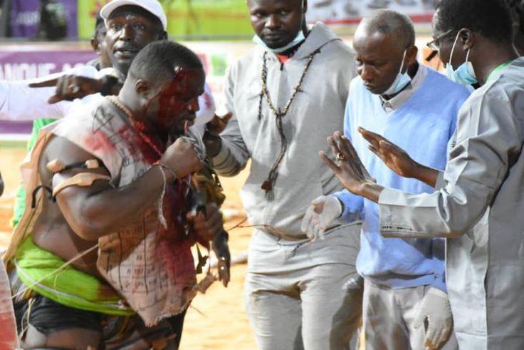 Blessure-Papa-Sow-vs-Siteu