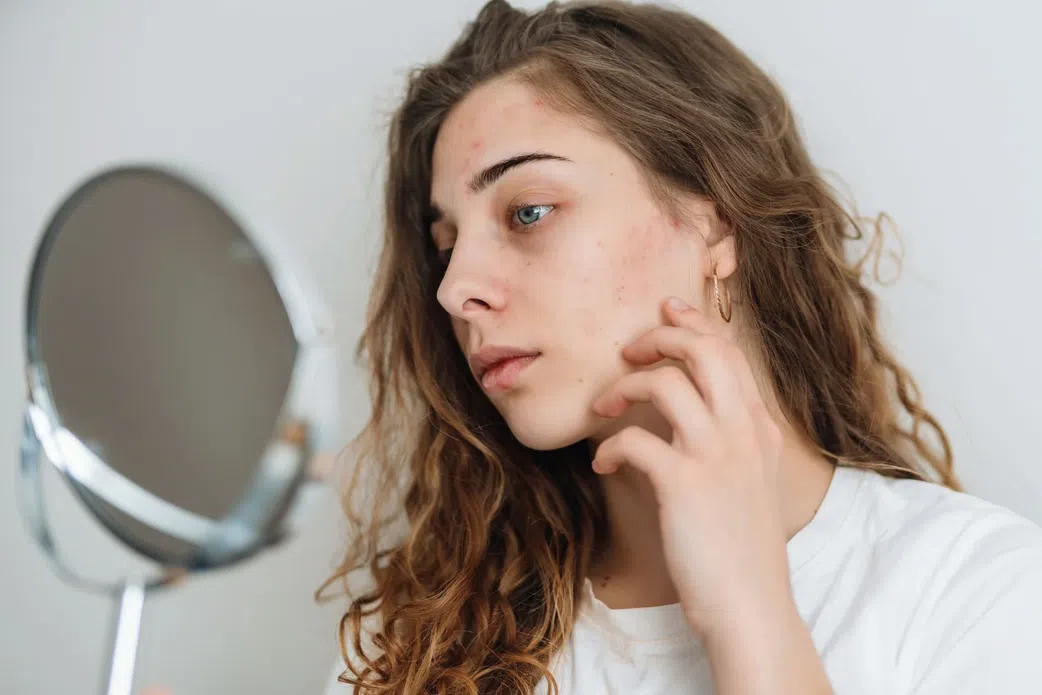 Ce bouton que vous ne devez jamais percer sur le visage