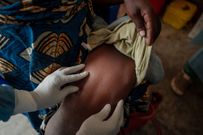 7 cas de Mpox, 277 cas de Fièvre de la vallée du RiftVR et 22 morts