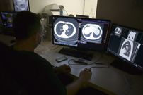 Cancer : la France championne mondiale, selon le Lancet