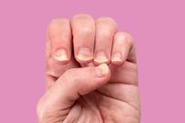 Diabète : ce détail surprenant sur vos ongles doit vous alerter !