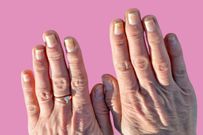 Diabète : ce détail surprenant sur vos ongles doit vous alerter !