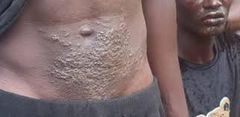 Sénégal : la cause de la maladie des pêcheurs identifiée 5 ans après